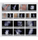 Венозний сканер Vein Probe-С