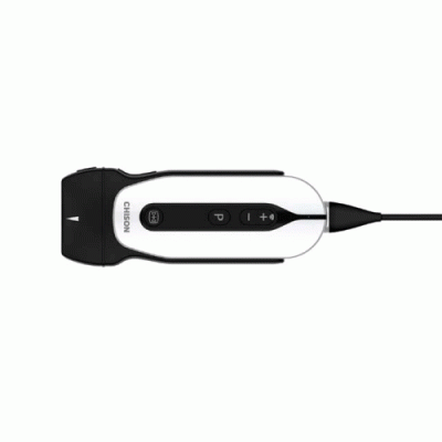 Портативний УЗ датчик SonoEye P2 ультразвуковий діагностичний