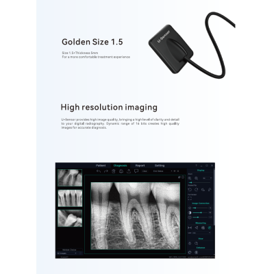 Визиограф u-Sensor H1,5 фото 5 