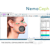 NemoSmile Design 3D