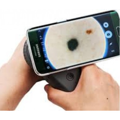 Дерматоскоп поляризаційний ILLUCO IDS-1100 фотографія 4 
