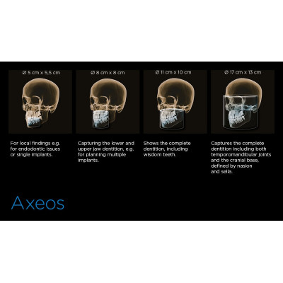 Рентген томограф Axeos Ceph, об'єм зйомки: від 5х5,5 до 17х13 см, з цефалостатом стоматологічний комп'ютерний томограф фотографія 6 