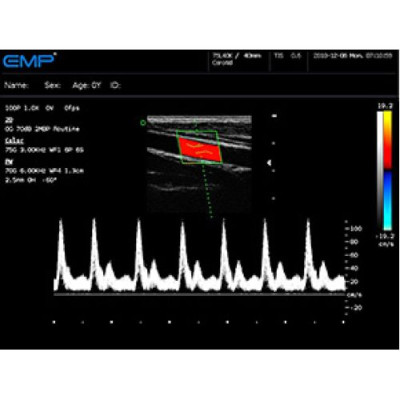 EMP G30 EMP G30 фотографія 6