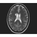 МРТ Сканер STERNMED – Marcom 0.5T фотографія 3